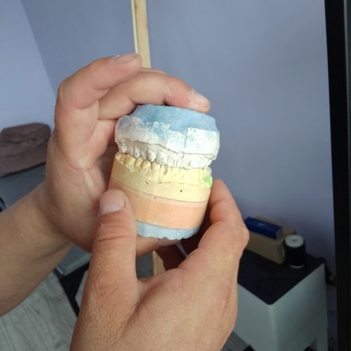 В Шагонаре по социальному контракту открыли производство зубных протезов