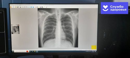 В больнице Тоджи заработал современный рентгенографический аппарат