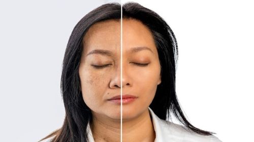 Кадык камгалал төптери элекке кырыырының амы-хууда чылдагаанын шинчилээр