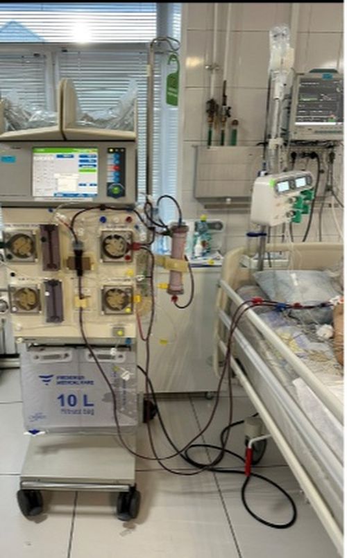 Республиканская больница №1 оснащена современным оборудованием для высокоэффективных процедур очистки крови