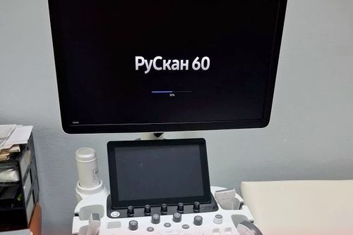 В Республиканском противотуберкулезном диспансере установили новый ультразвуковой аппарат «РуСкан 60»