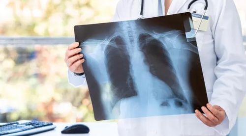 Сегодня - Всемирный день борьбы с туберкулёзом