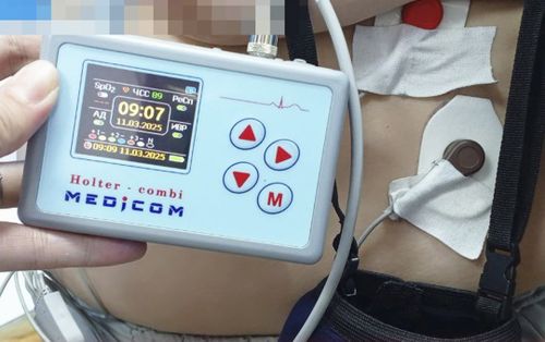 В Дзун-Хемчикский ММЦ доставили новое оборудование в рамках нацпроекта