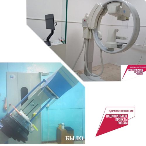 В декабре прошлого года Барун-Хемчикский ММЦ получил новый маммограф и начал успешно работать с 26 декабря 2022 года