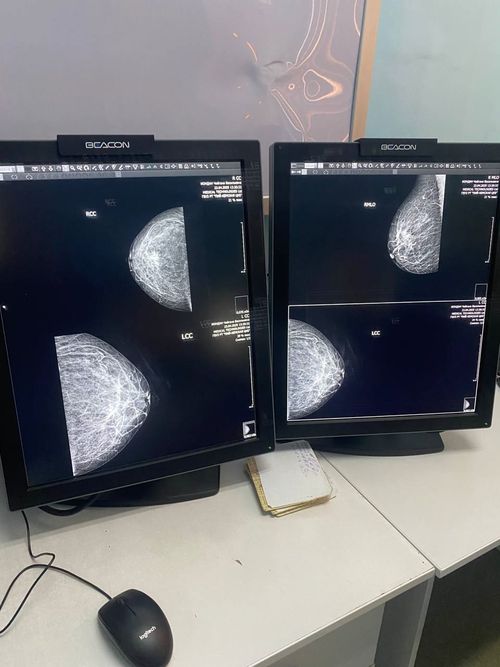 В Пий-Хемскую районную больницу поступил новый маммограф