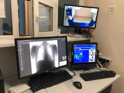 На страже здоровья: новые рентген-аппараты и узи-оборудование экспертного класса в районах республики успешно используются