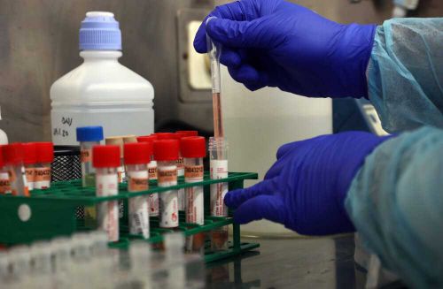 Светящийся глаз. «Росатом» предложил новый метод лечения коронавируса