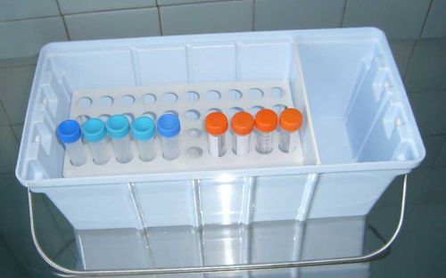 Анализы на «ковид» по-прежнему задерживаются в пути