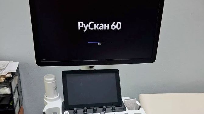 В Республиканском противотуберкулезном диспансере установили новый ультразвуковой аппарат «РуСкан 60»